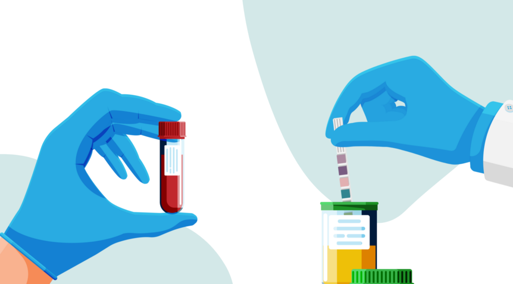 Graphic of two gloved hands testing blood and urine specimens